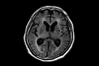 Brain imaging with MultiVane XD