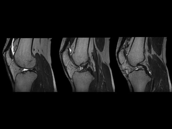 Sagittal T2w MSK View dS SENSE = 4.4