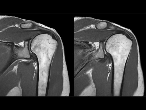 PDw TSE dS Flex M + dS Posterior coil