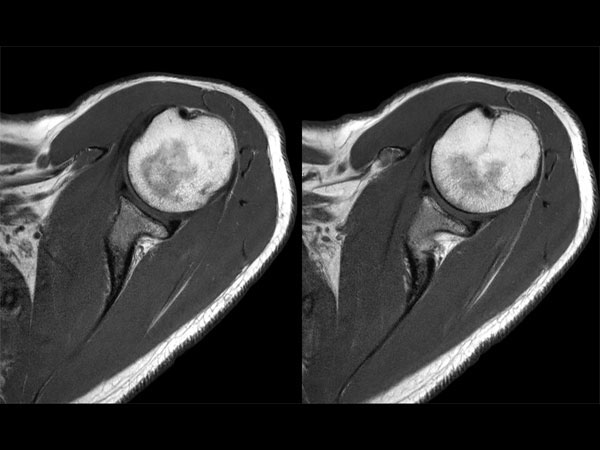 T1w TSE dS Flex M + dS Posterior coil