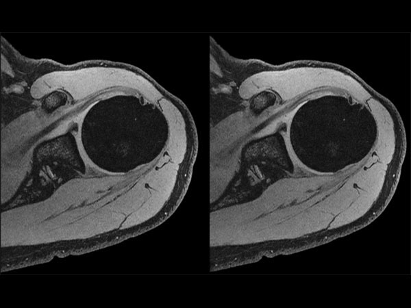 3D mFFE dS Flex M + dS Posterior coil