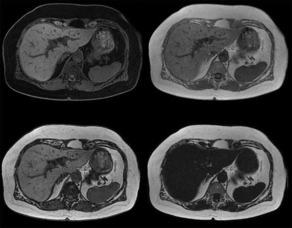 mDIXON FFE dS SENSE = 3
