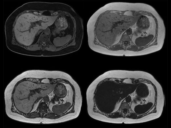 mDIXON FFE dS SENSE = 3