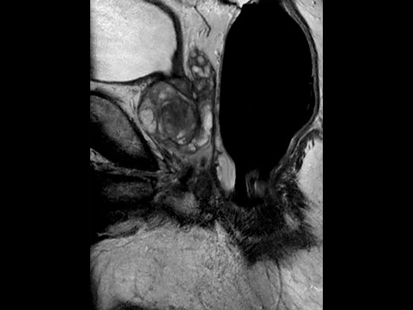 Sagittal T2w TSE