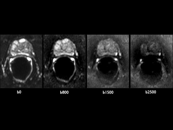 Axial Diffusion