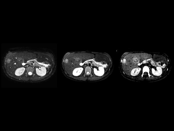 Axial Diffusion (b0, b50, b800)