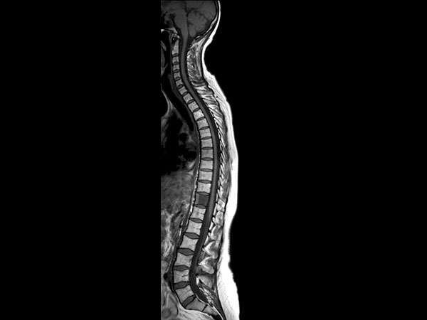 Sagittal T1w TSE