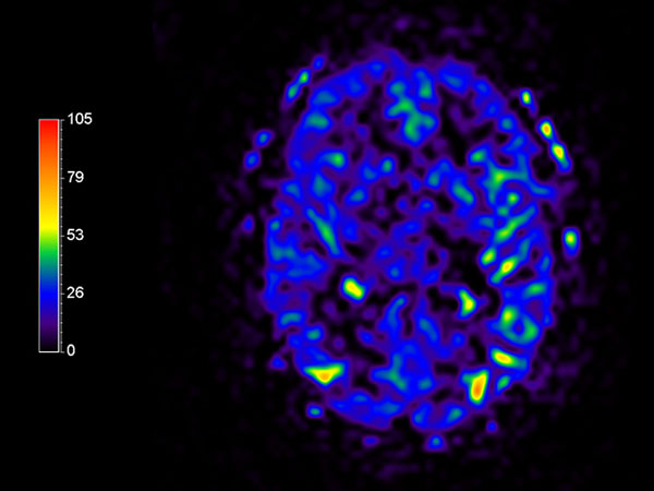 Axial pCASL