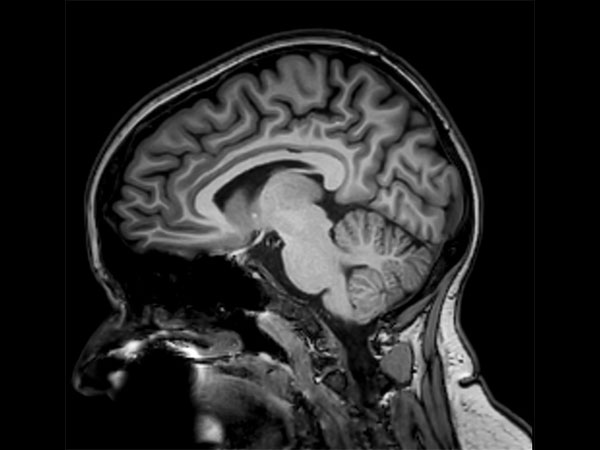 Sagittal 3D T1w FFE