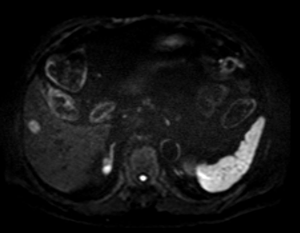 Axial Diffusion (b800)
