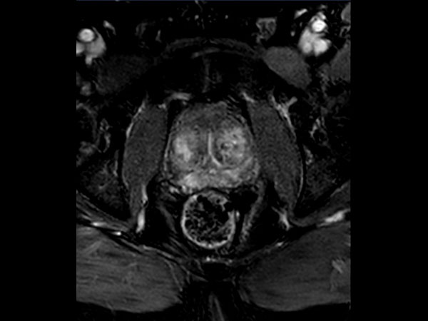 Axial dynamic mDIXON FFE