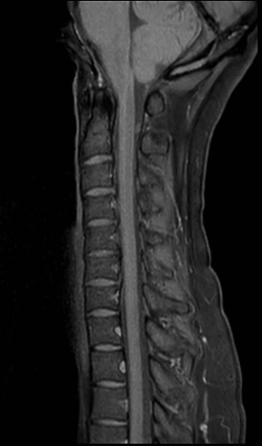 Sagittal T1w mDIXON TSE (Water)