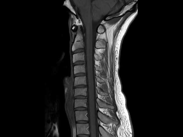 Sagittal T1w TSE