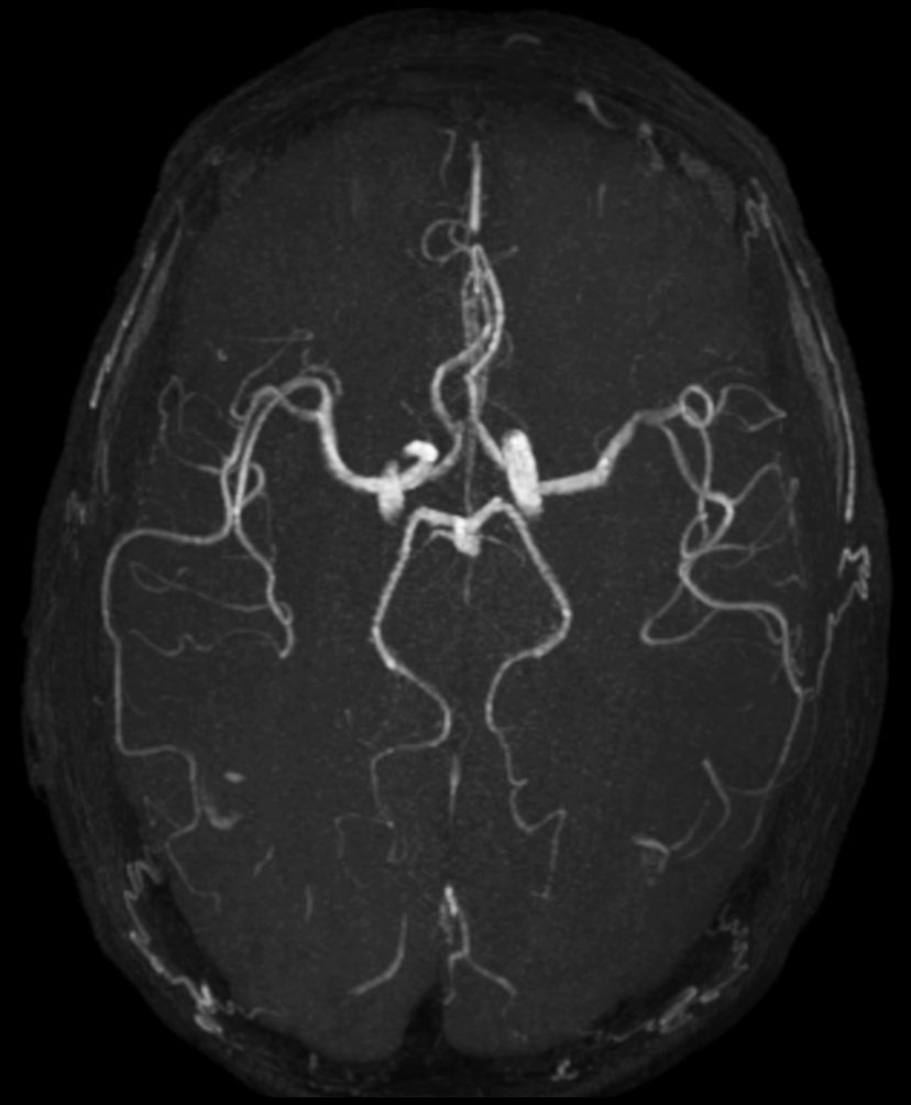 3D Inflow - ComforTone