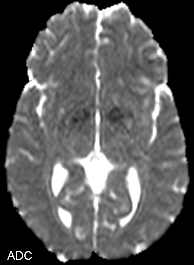 Diffusion - ComforTone