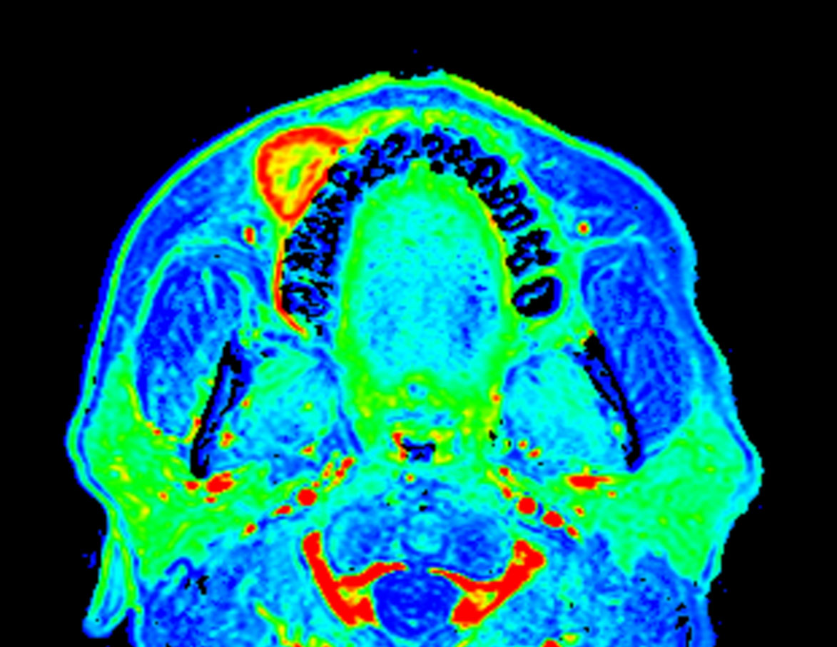 Axial eTHRIVE (area under the curve)