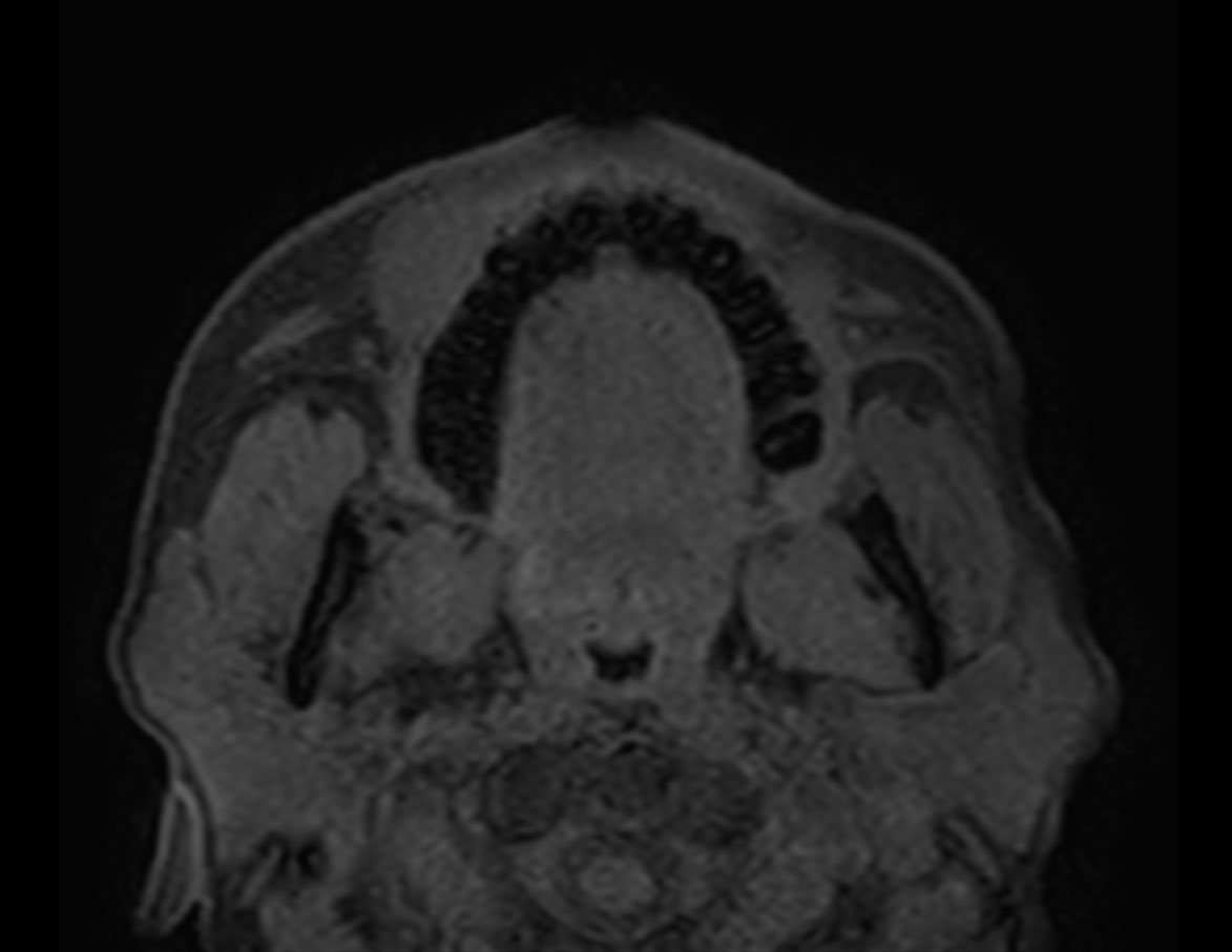 Axial eTHRIVE (blanco)