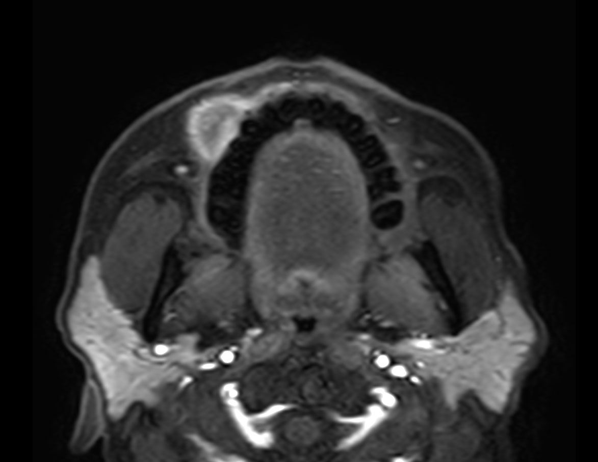 Axial eTHRIVE (1st dynamic)