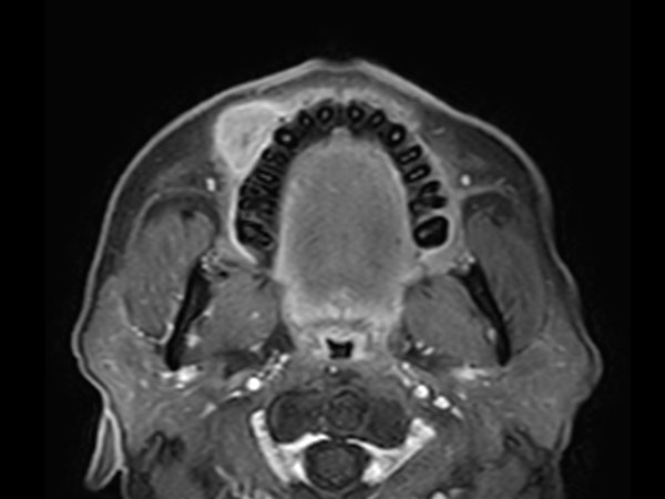 Axial dynamic eTHRIVE