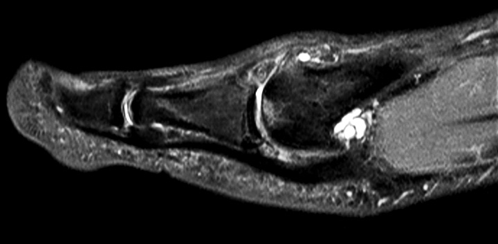 Sagittal PDw mDIXON TSE  (water only)
