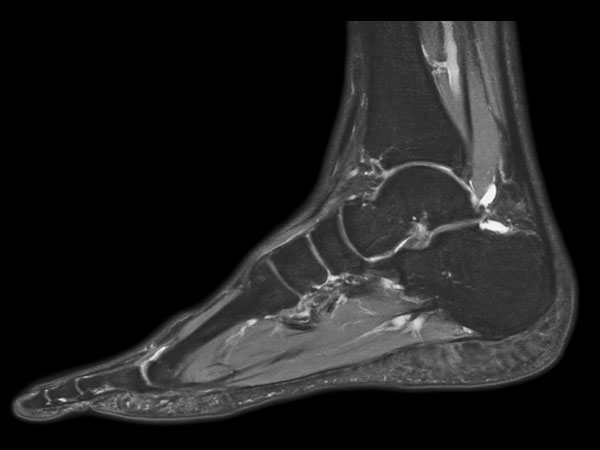 Sagittal PDw mDIXON TSE  (water only)