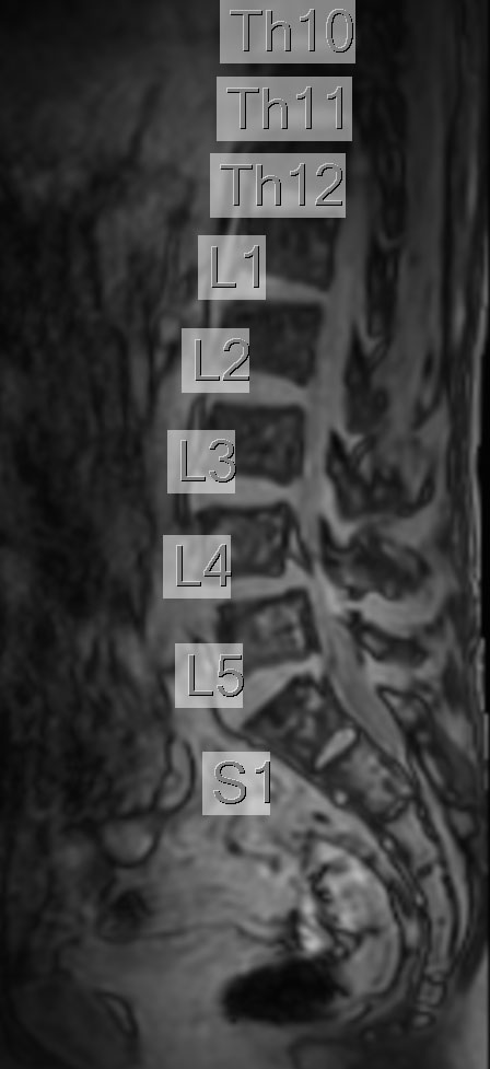 SmartExam Spine <sup>1</sup>