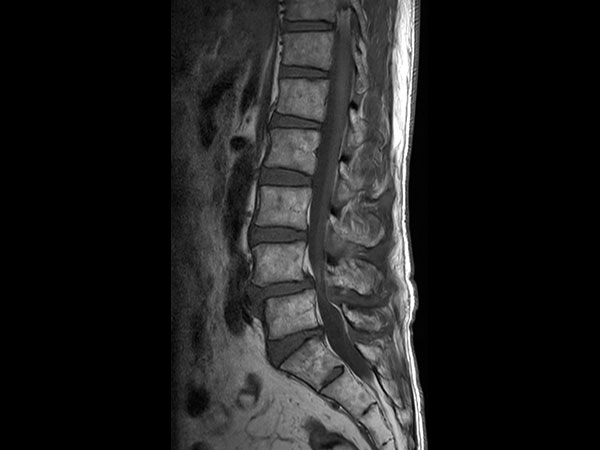 Sagittal T1w TSE