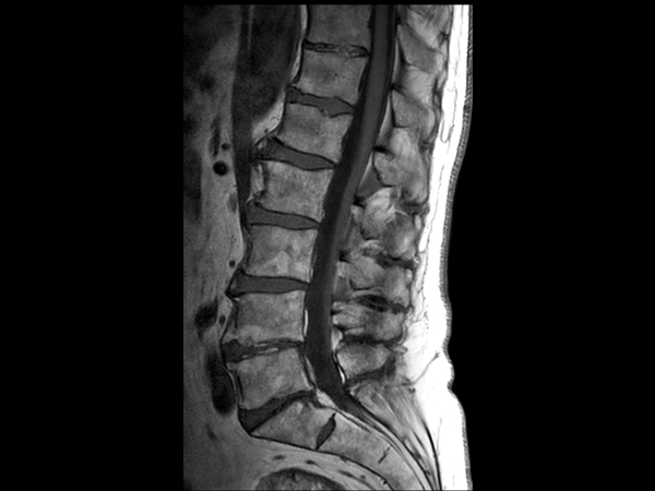 Sagittal T1w TSE 