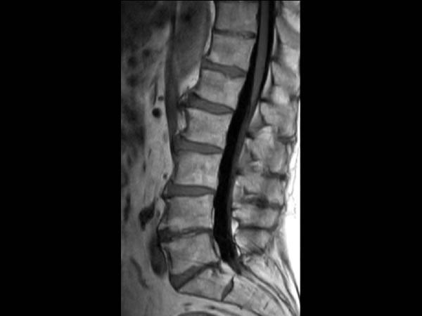 Sagittal T1w FLAIR 