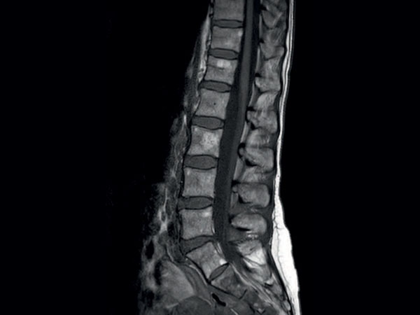 Sagittal T1w TSE