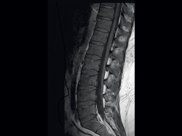 Sagittal T1w TSE