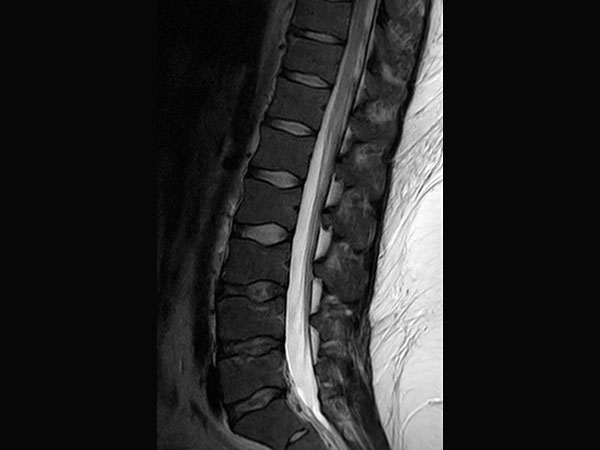 Sagittal T2w TSE