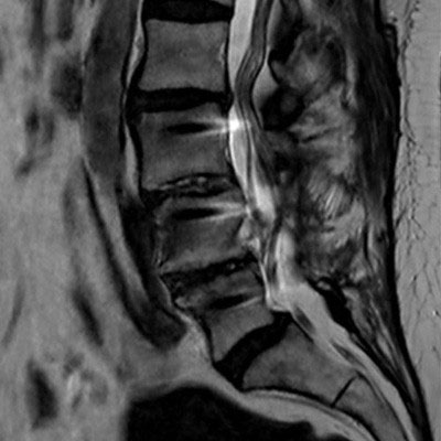 Sagittal T2w TSE (routine)