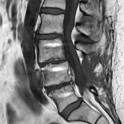 Sagittal T1w TSE (routine) 
