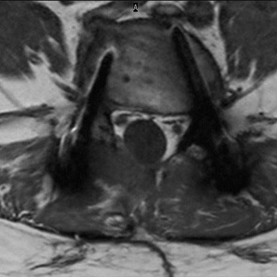 Axial T1w TSE (routine)