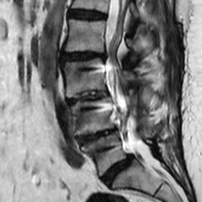 Sagittal T2w TSE (fast)