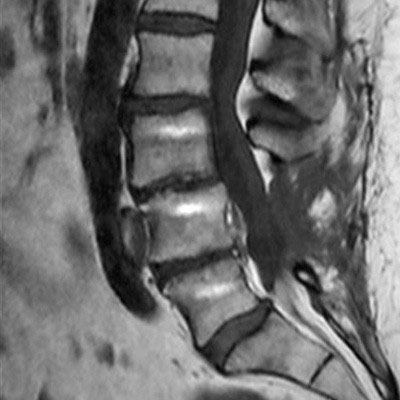 Sagittal T1w TSE (fast)
