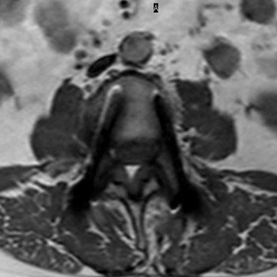 Axial T1w TSE (fast)