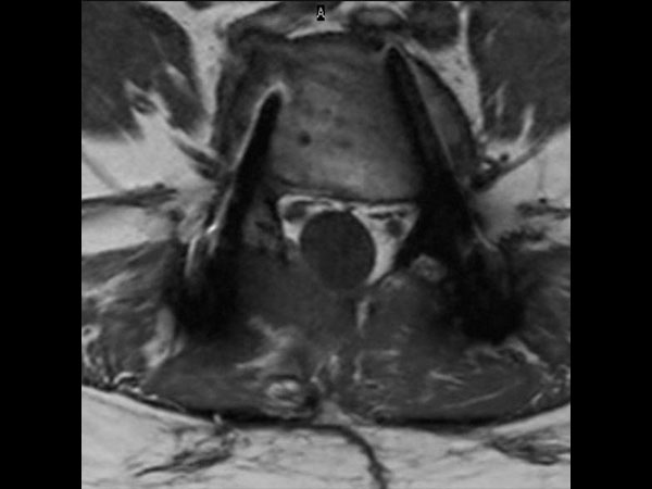 Axial T1w TSE (routine)