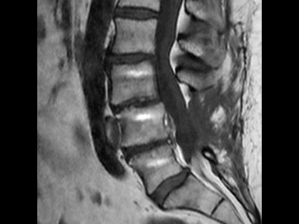 Sagittal T1w TSE (fast)