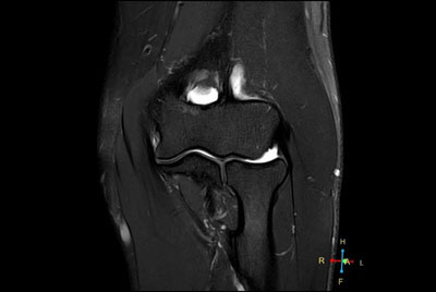High resolution Elbow imaging