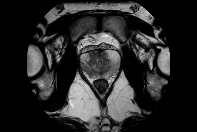 Motion-free Prostate imaging 