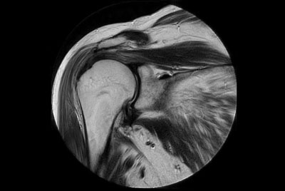 Motion-free Shoulder imaging 