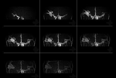 Contrast-free imaging of brain vascular anatomy