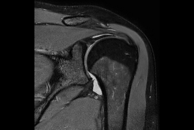 Routine shoulder imaging