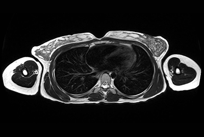 Chest imaging