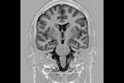 Brain overview