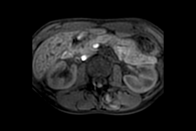 Liver and Pancreas