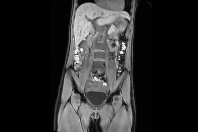 Total Torso overview