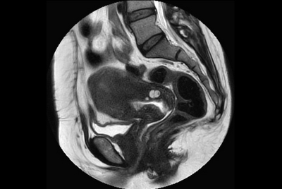 Female Pelvis overview